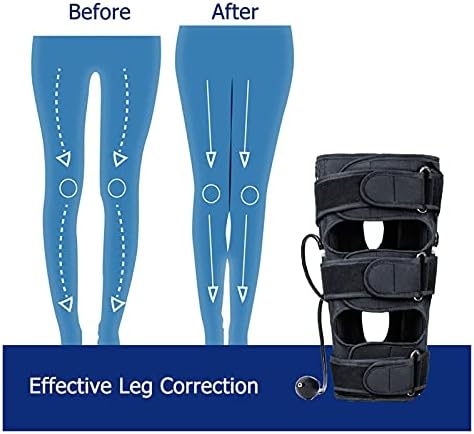 WYFC Ayarlanabilir O / X Tipi Bacak Düzeltme Bandı Etkili Yaylı Bacaklar Diz Valgum doğrultma kemeri duruş düzeltici Güzellik