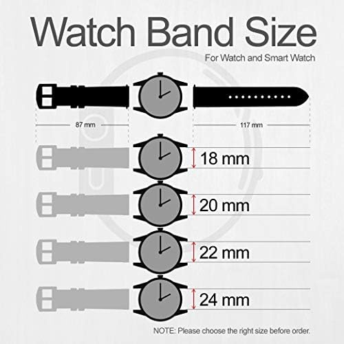 CA0246 Pembe Dudaklar Öper Deri ve Silikon akıllı saat Band Kayışı Kol Saati Smartwatch akıllı saat Boyutu (20mm)